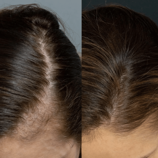 Understanding Shock Loss and New Growth