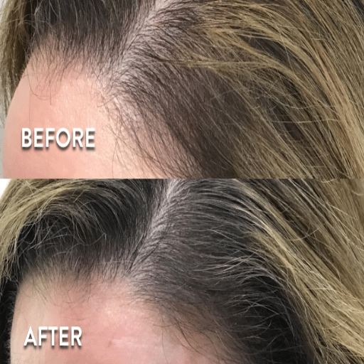 Final Outcome and Long-Term Care