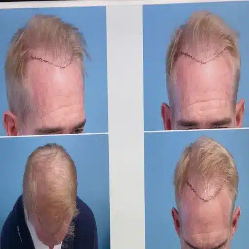 joe buck