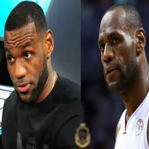 lebron james the journey before the hair transplant