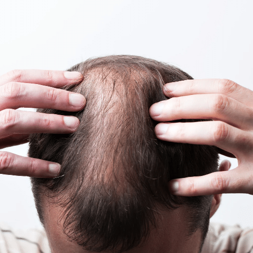 Natural Remedies to Promote Hair Growth