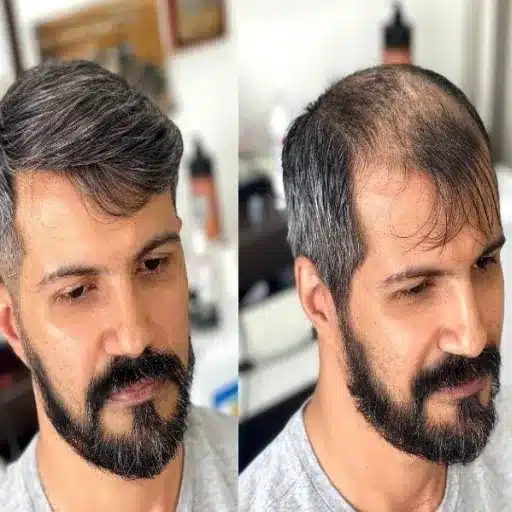 Stylish Solutions for Older Men’s Hairstyles That Suit Thinning Hair Perfectly styles to avoid for older men with thinning hair