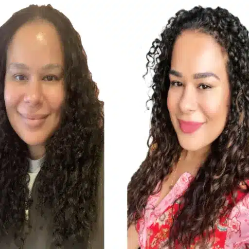 Long Hair After Transplant: A Comprehensive Guide to Growth and Care success stories achieving rapunzel dreams