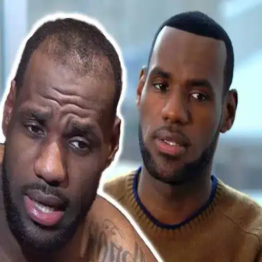 Exploring the Challenges Faced by LeBron James Before Hair Transplant Decisions understanding hair loss in athletes