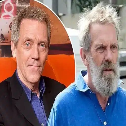 The Truth Behind Hugh Laurie Hair Transplant: A Closer Look at His Hair Transformation visual evidence hugh laurie