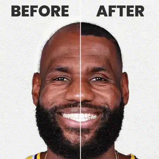 Exploring the Challenges Faced by LeBron James Before Hair Transplant Decisions lebron james before hair transplant