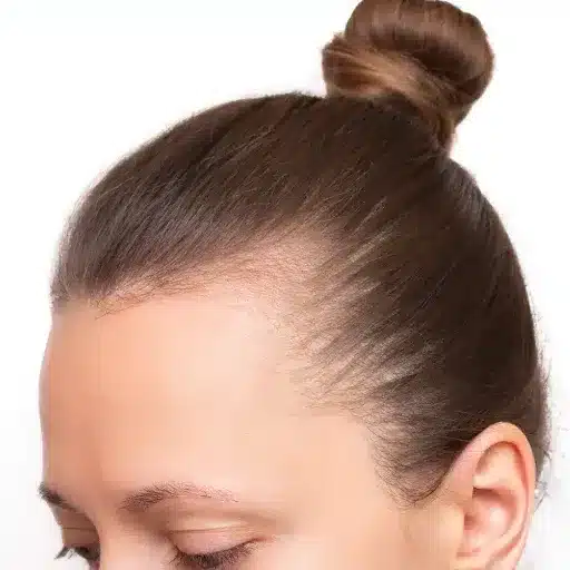 hair growth solutions and products