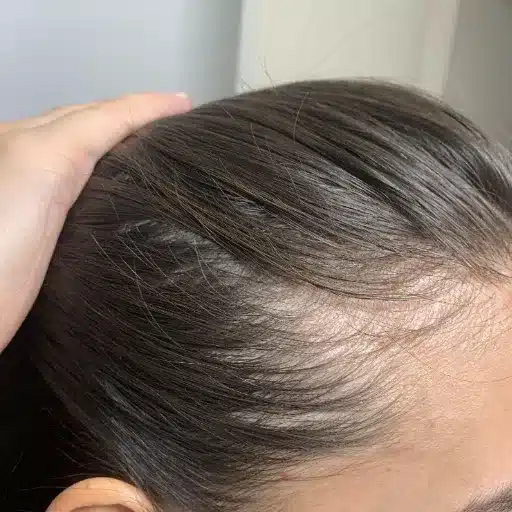 hairstyles for thinning hair